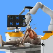 Robotic Knee replacement surgery in Pune - Dr. Murtaza Adeeb