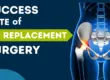 Success rate of hip replacement surgery in india