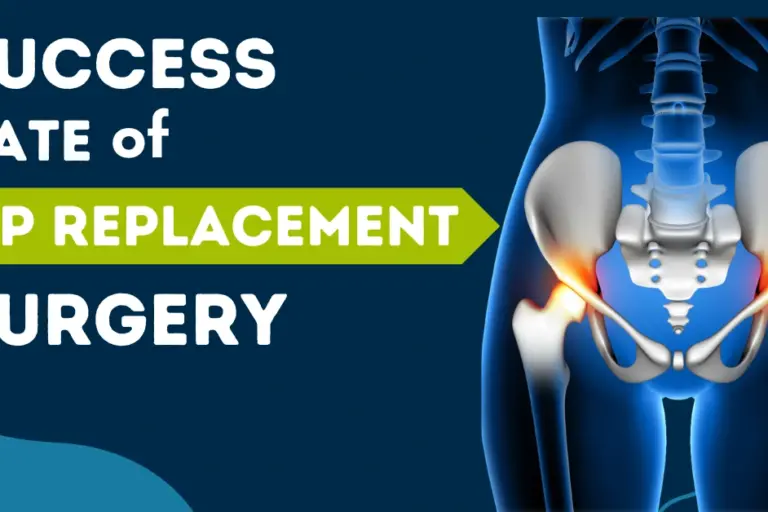 Success rate of hip replacement surgery in india