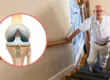 is it possible Climbing stairs after knee replacement surgery ? Absolutely Yes