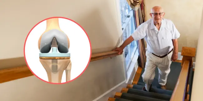 is it possible Climbing stairs after knee replacement surgery ? Absolutely Yes is it possible Climbing stairs after knee replacement surgery ? Absolutely Yes