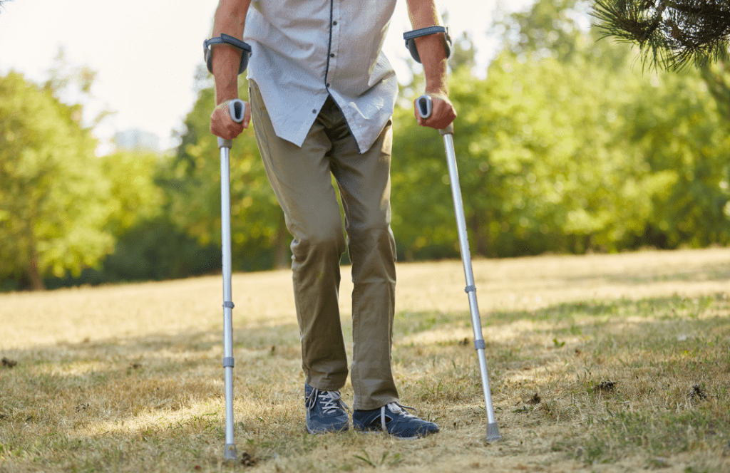 Can You Climb Stairs After Knee Replacement Surgery DR MURTAZA ADEEB