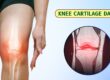 Knee Cartilage Damage - Symptoms & Causes