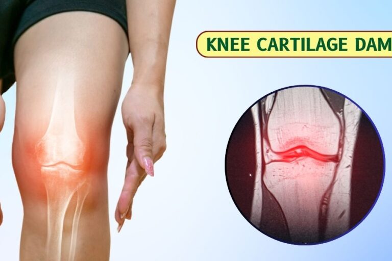 Knee Cartilage Damage - Symptoms & Causes