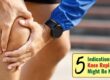 5 signs that knee replacement might be necessary