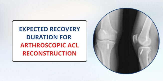 arthroscopic-acl-reconstruction Arthroscopic ACL Reconstruction