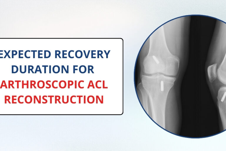 Arthroscopic ACL Reconstruction