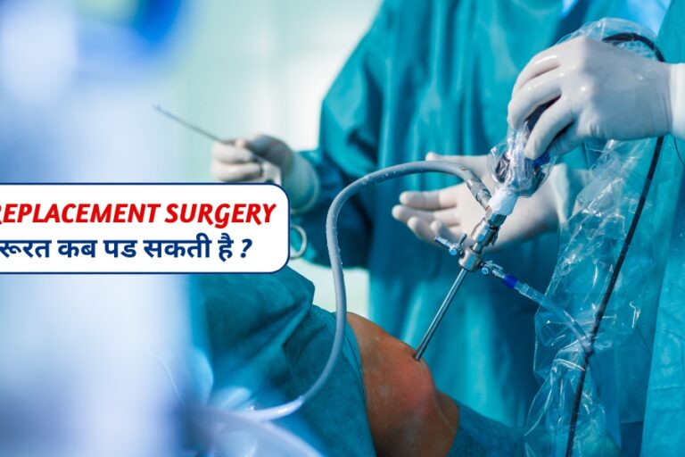 knee replacement surgery की जरूरत कब पड सकती है
