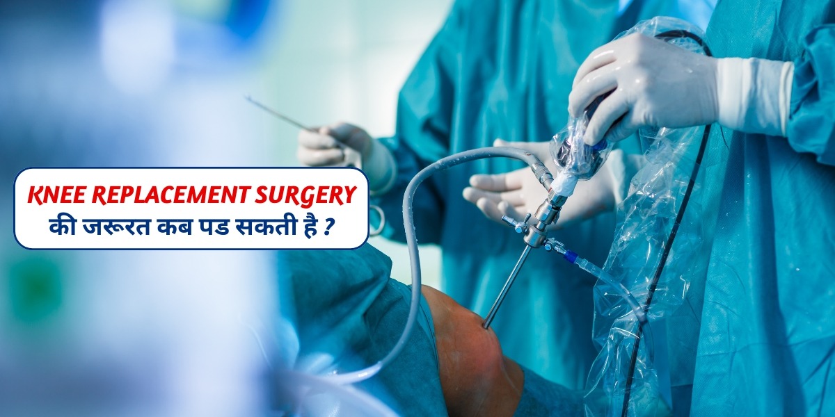 knee replacement surgery की जरूरत कब पड सकती है