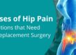 Causes of hip pain - conditions that need hip replacement surgery