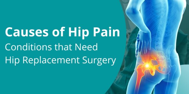 Hip Pain Causes of hip pain - conditions that need hip replacement surgery