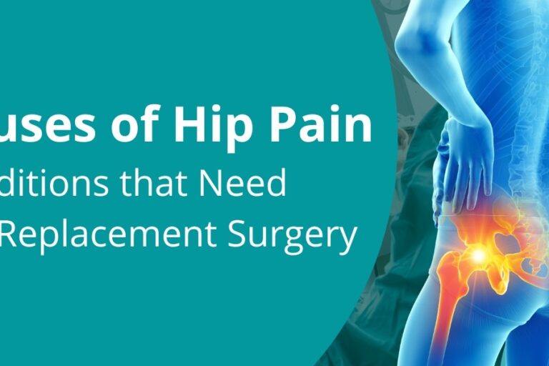 Hip Pain Causes of hip pain - conditions that need hip replacement surgery
