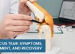 Meniscus Tear: Symptoms, Treatment, and Recovery