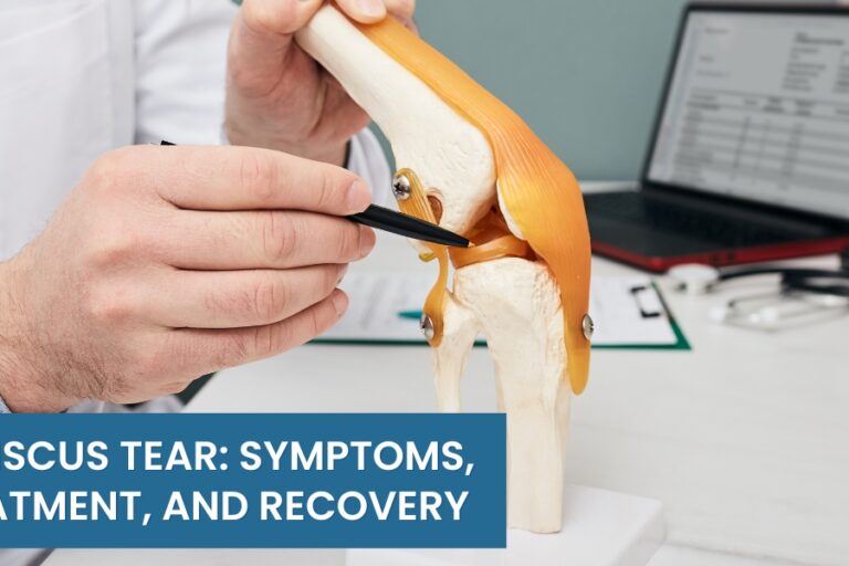 Meniscus Tear: Symptoms, Treatment, and Recovery