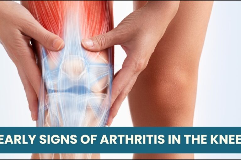 Arthritis Treatment