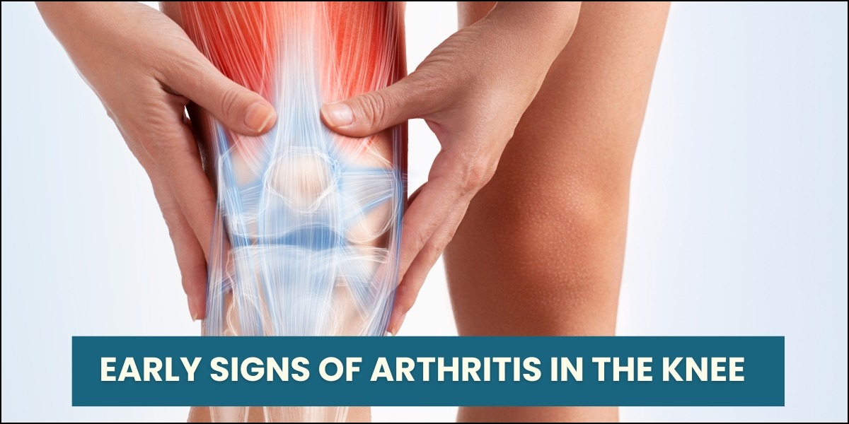 Arthritis Arthritis Treatment