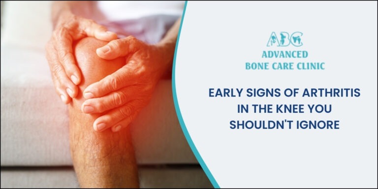 Early signs of arthritis in the knee