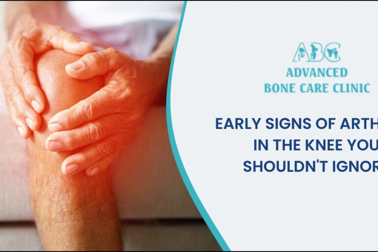 Early signs of arthritis in the knee