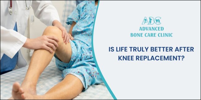 Is life truly better after a knee replacement?
