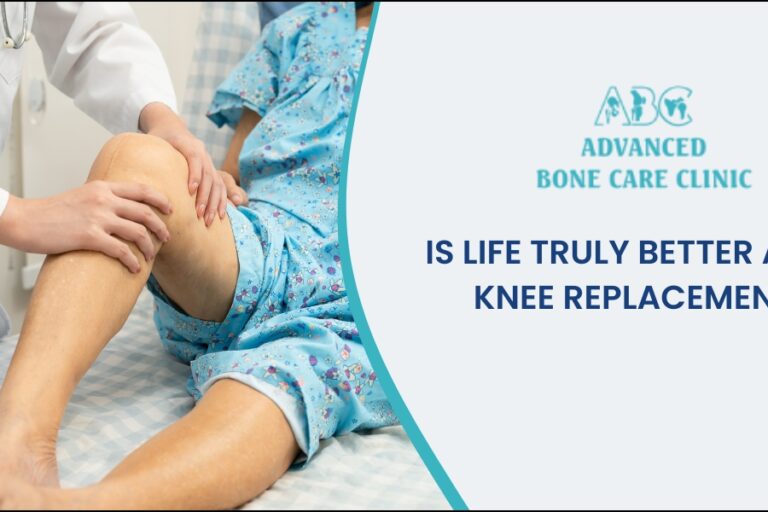 Is life truly better after a knee replacement?