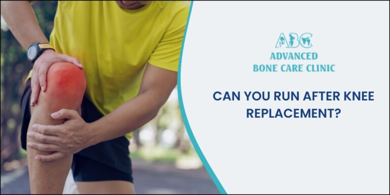 Is running possible after knee replacement?