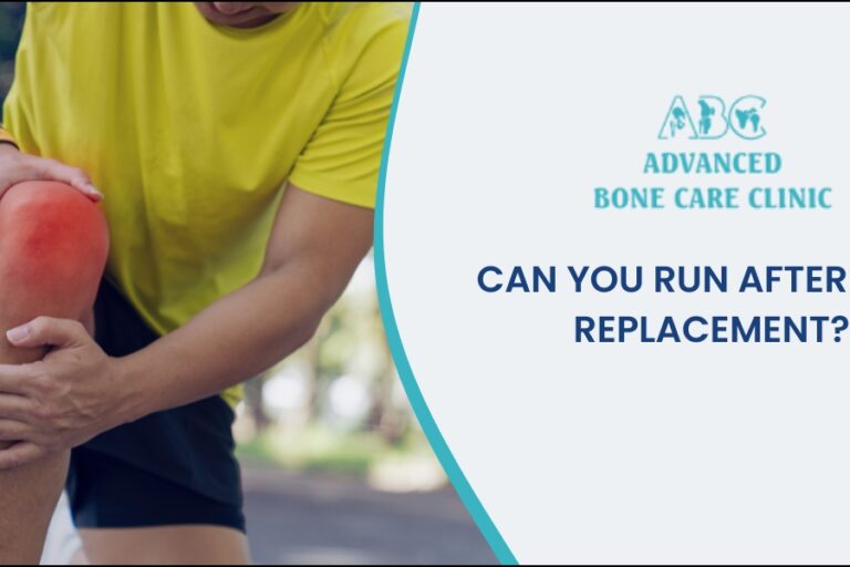 Knee Replacement Is running possible after knee replacement?