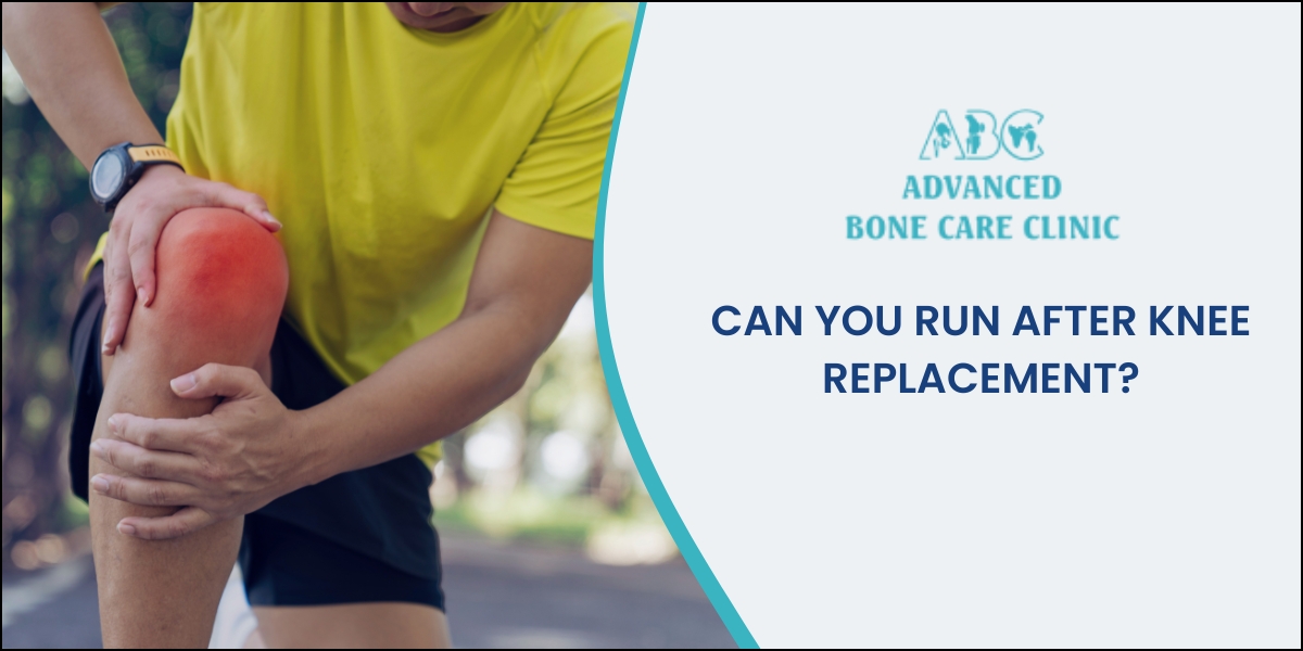 Knee Replacement Is running possible after knee replacement?