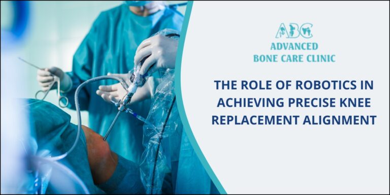 Robotic Knee Replacement Robotic knee replacement surgery