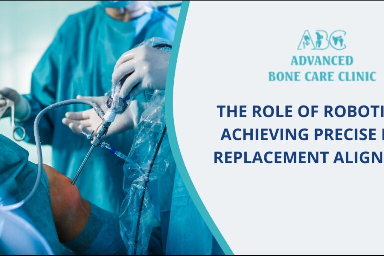 Robotic knee replacement surgery