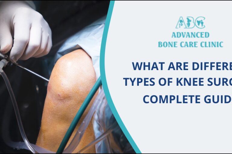 Types of knee surgery