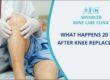 Knee Replacement Surgery in Pune