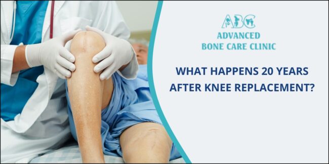 Knee Replacement Surgery Knee Replacement Surgery in Pune