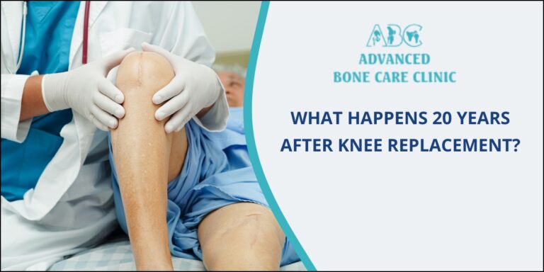 Knee Replacement Surgery Knee Replacement Surgery in Pune