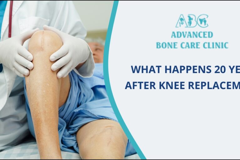 Knee Replacement Surgery in Pune
