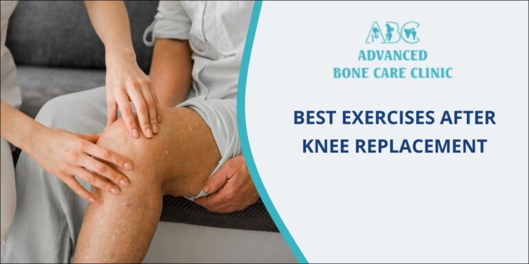 Knee Pain Exercise Best Exercises After Knee Replacement