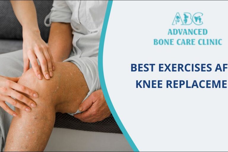 Best Exercises After Knee Replacement