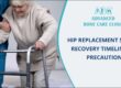 Hip replacement surgery recovery timeline